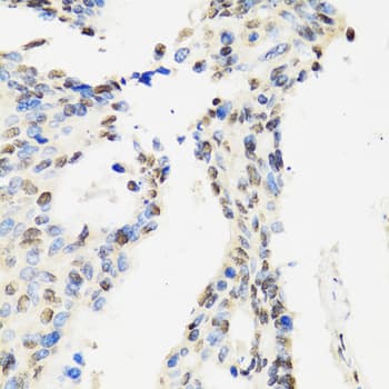 CCAR2 / KIAA1967 Antibody