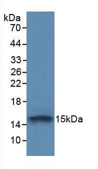 FGFR1 / FGF Receptor 1 Antibody