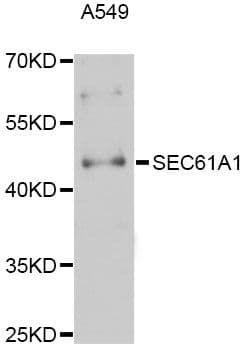 Polyclonal Rabbit anti-Human SEC61A1 / SEC61 Antibody (WB)