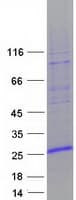 Human ZNHIT3 Protein (Recombinant Myc-DDK (Flag))
