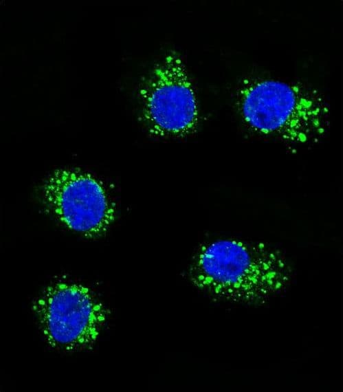 MUSK Antibody (aa70-366)