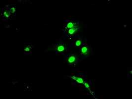 Monoclonal Mouse anti-Human BUB1B / BubR1 Antibody (clone OTI15E11, IHC, IF, WB)
