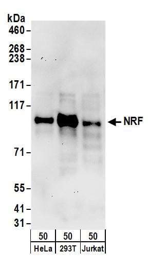 IHC-plus™ XPO5 / Exportin 5 Antibody (aa1154-1204)