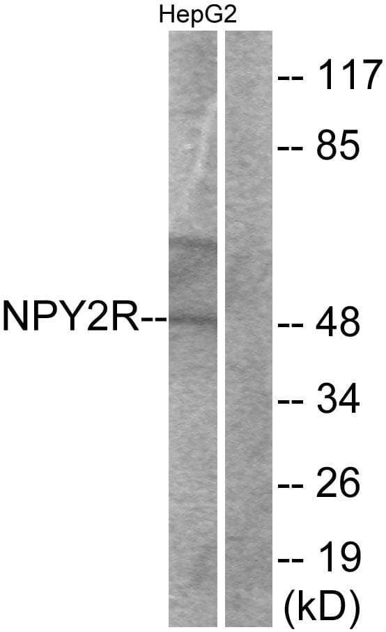 Polyclonal Rabbit anti-Human NPY2R Antibody (IF, WB)
