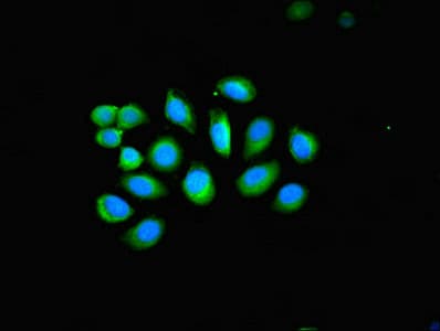Polyclonal Rabbit anti-Human KRT4 / CK4 / Cytokeratin 4 Antibody (WB)