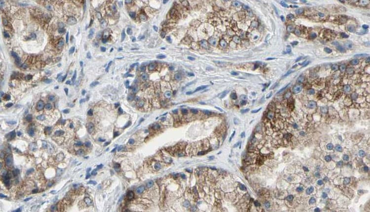 Polyclonal Rabbit anti-Human GOLGA2 / GM130 Antibody (IHC, IF, WB)