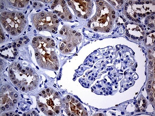 Monoclonal Mouse anti-Human FHIT Antibody (clone OTI1D7, IHC, WB)