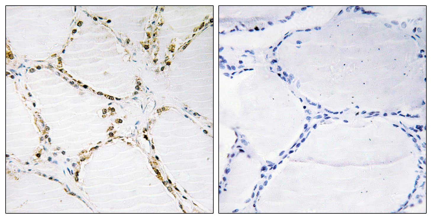 Polyclonal Rabbit anti-Human FOXO1 / FKHR Antibody (aa291-340, IHC)