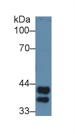 HP / Haptoglobin Antibody (aa104-346, Biotin)