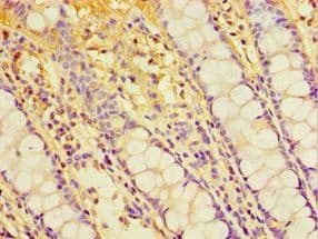 Polyclonal Rabbit anti-Human CHRFAM7A Antibody (aa1-150, IHC)