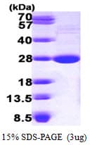 Mouse LYPLA1 Protein (Recombinant His)