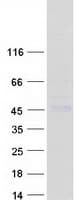Human CTSH / Cathepsin H Protein (Recombinant Myc-DDK (Flag))