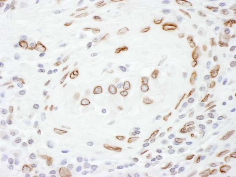 LMNA / Lamin A+C Antibody (aa400-450)