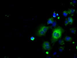 Basigin / Emmprin / CD147 Antibody (clone OTI9H5)