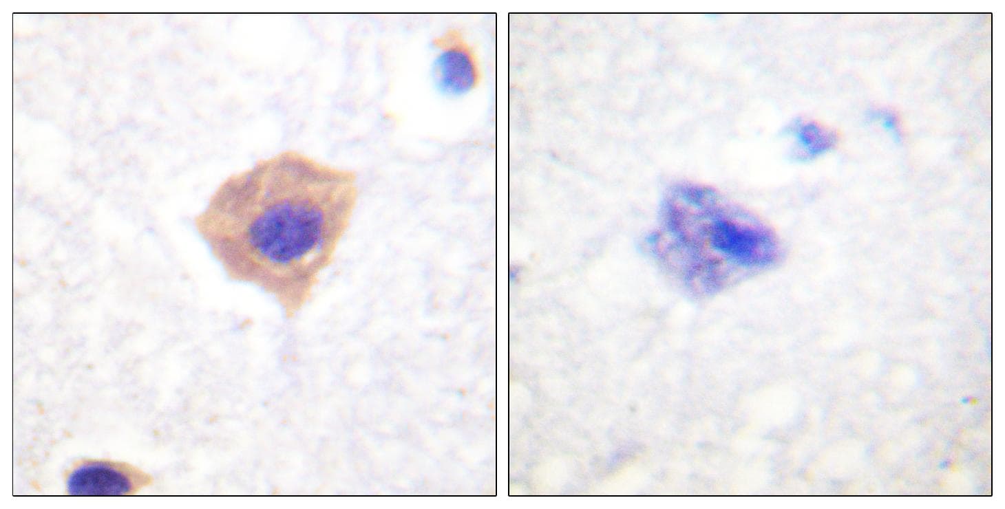 Polyclonal Rabbit anti-Human CAT / Catalase Antibody (Ab-385, IHC)