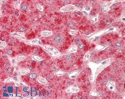 IHC-plus™ Polyclonal Rabbit anti-Human NOS2 / iNOS Antibody (aa830-860, IHC, IF, WB)