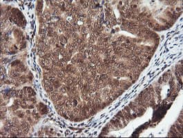 FAK / Focal Adhesion Kinase Antibody (clone OTI4A8)