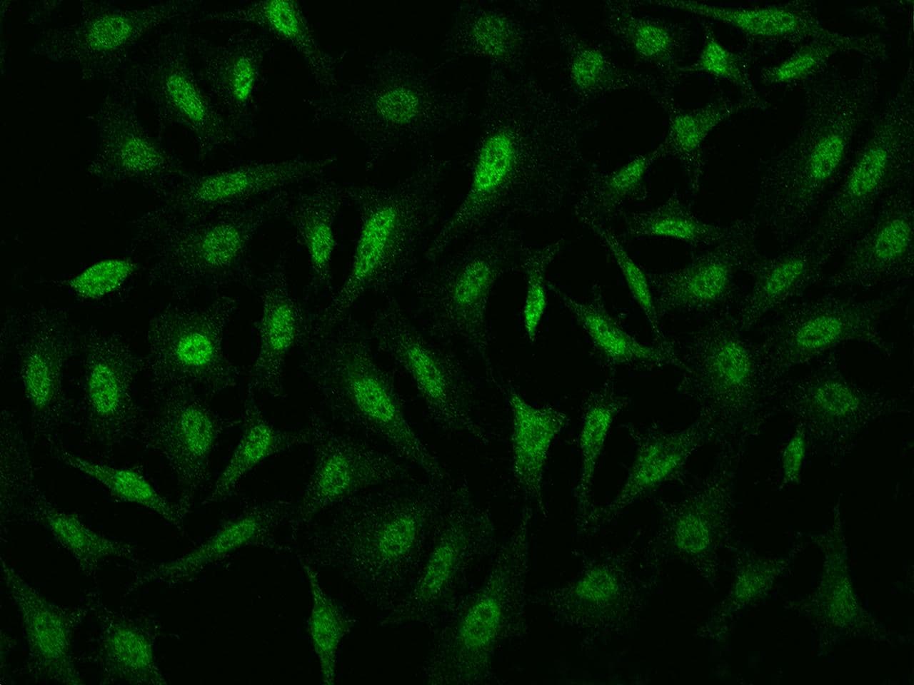 PPP1R8 / Rnase E Antibody