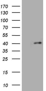 FOXR1 Antibody (clone OTI3D8)