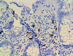 CTLA4 / CD152 Antibody (C-Terminus, clone RBT-CTLA4)