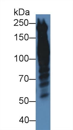 PPL / Periplakin Antibody (aa1439-1716)