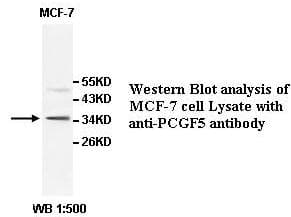 Polyclonal Rabbit anti-Human PCGF5 Antibody (aa1-256, WB)