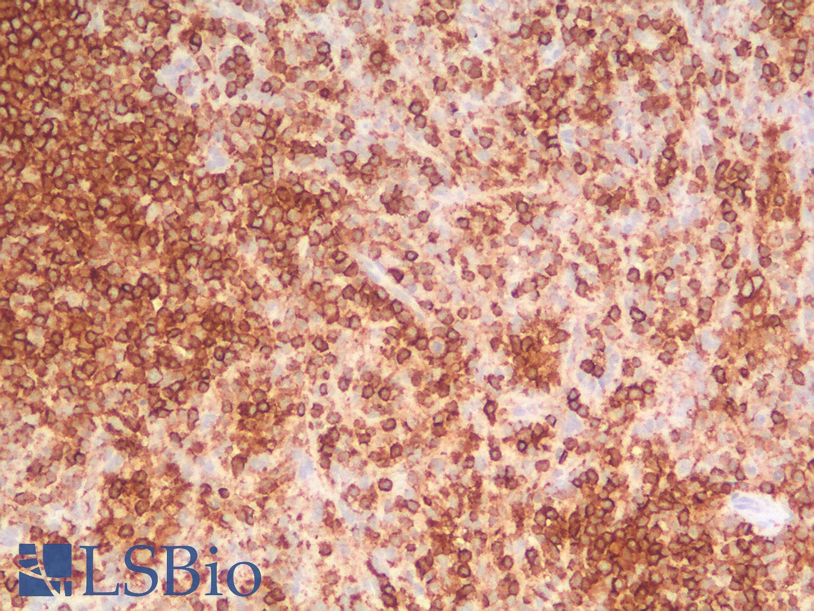 PathPlus™ CD45RB Antibody (clone PTPRC/2877R)