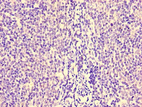 HCP5 Antibody