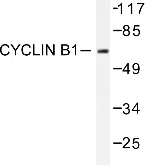 CCNB1 / Cyclin B1 Antibody (Ile120)