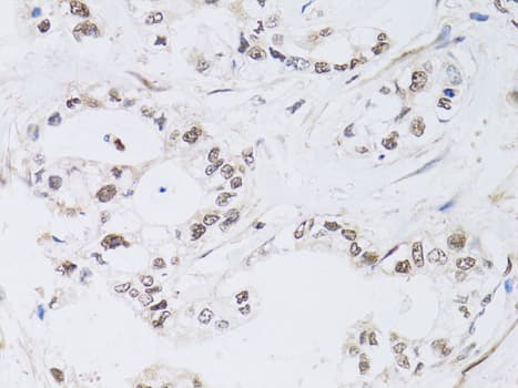 PAX3 Antibody