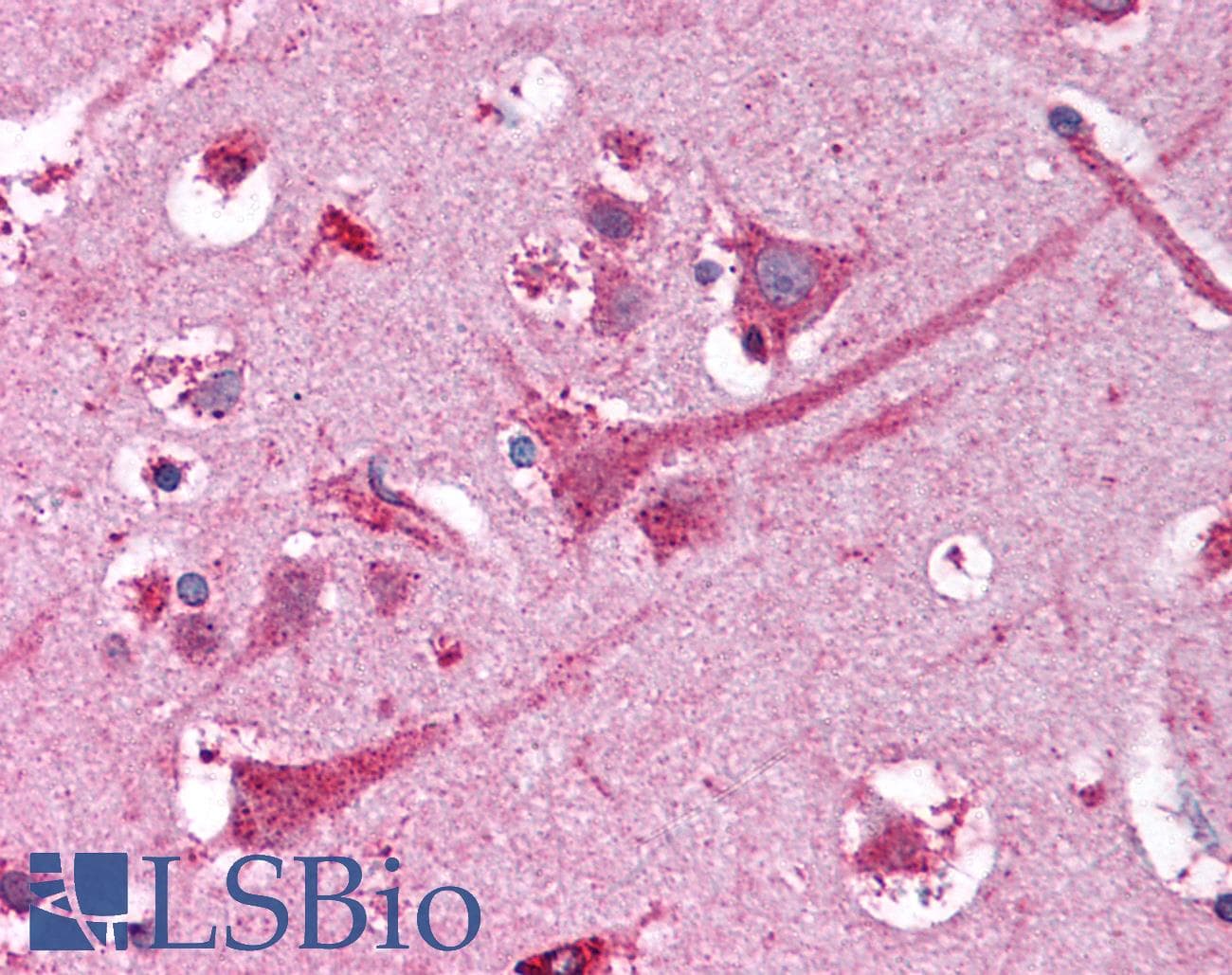 IHC-plus™ NEK9 Antibody