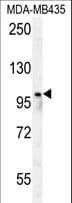 PARP8 Antibody (aa632-660)