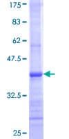 Human UGT2B7 Protein (Recombinant GST, N-terminus)