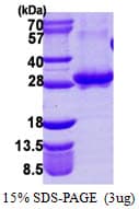 Human RAB3A Protein (Recombinant His)