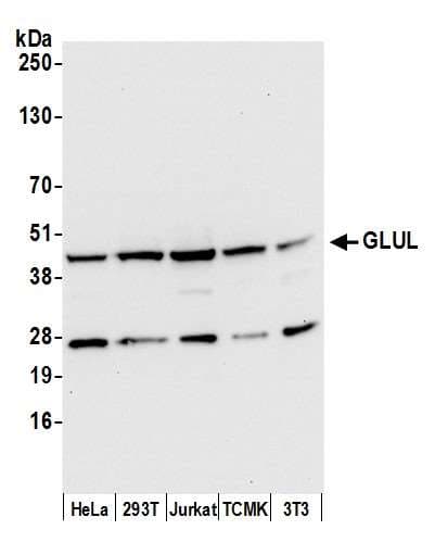 GLUL / Glutamine Synthetase Antibody (aa323-373)