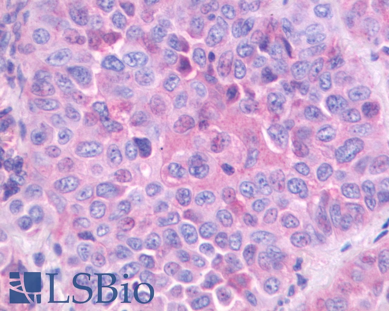 PathPlus™ Polyclonal Rabbit anti-Human GRPR Antibody (Extracellular Domain, IHC, WB)