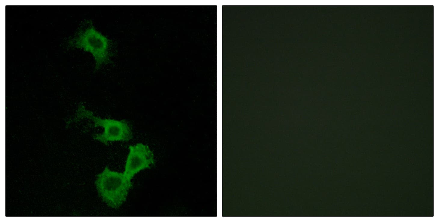 IHC-plus™ Polyclonal Rabbit anti-Human DAB1 Antibody (aa199-248, IHC, IF, WB)