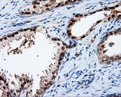 Monoclonal Mouse anti-Human APP / Beta Amyloid Precursor Antibody (clone OTI3E3, IHC, IF, WB)
