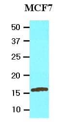 IHC-plus™ UBE2L6 Antibody (aa1-152, clone K1H3)