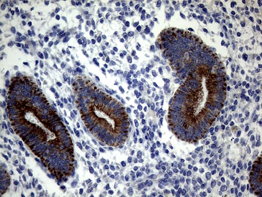 KRT18 / CK18 / Cytokeratin 18 Antibody (aa69-372, clone OTI10G8)