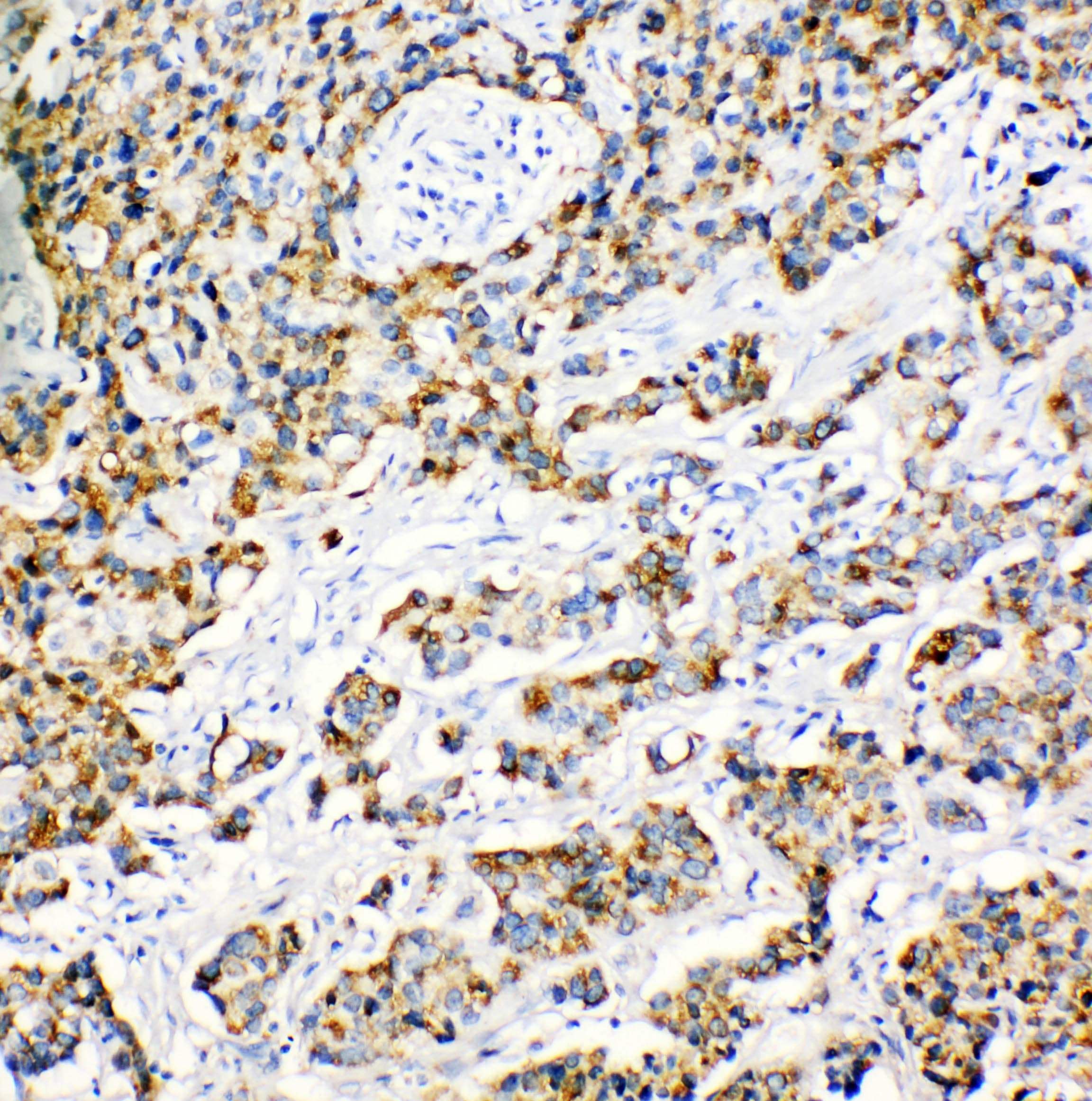 PRDX3 / Peroxiredoxin 3 Antibody (aa240-257)