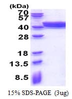 Human ACAD8 Protein (Recombinant His)