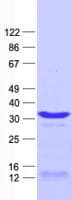 Human VHL / Von Hippel Lindau Protein (Recombinant His, N-Terminal)