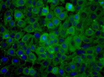 PKM / Pyruvate Kinase, Muscle Antibody (aa350-450)