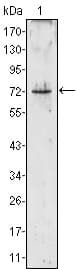 Monoclonal Mouse anti-Human PRTN3 / Myeloblastin Antibody (clone 3B4, WB)