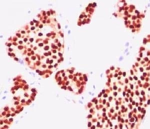 Estrogen Receptor Antibody (aa2-185, clone NR3Ga-1)