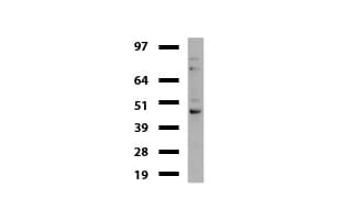 TP / Thymidine Phosphorylase Antibody (aa311-482, clone UMAB98, Carrier-free)