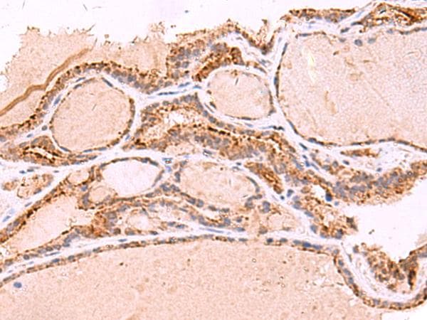 RABEPK / p40 Antibody