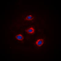 ADD1 / Adducin Alpha Antibody (C-Terminus)