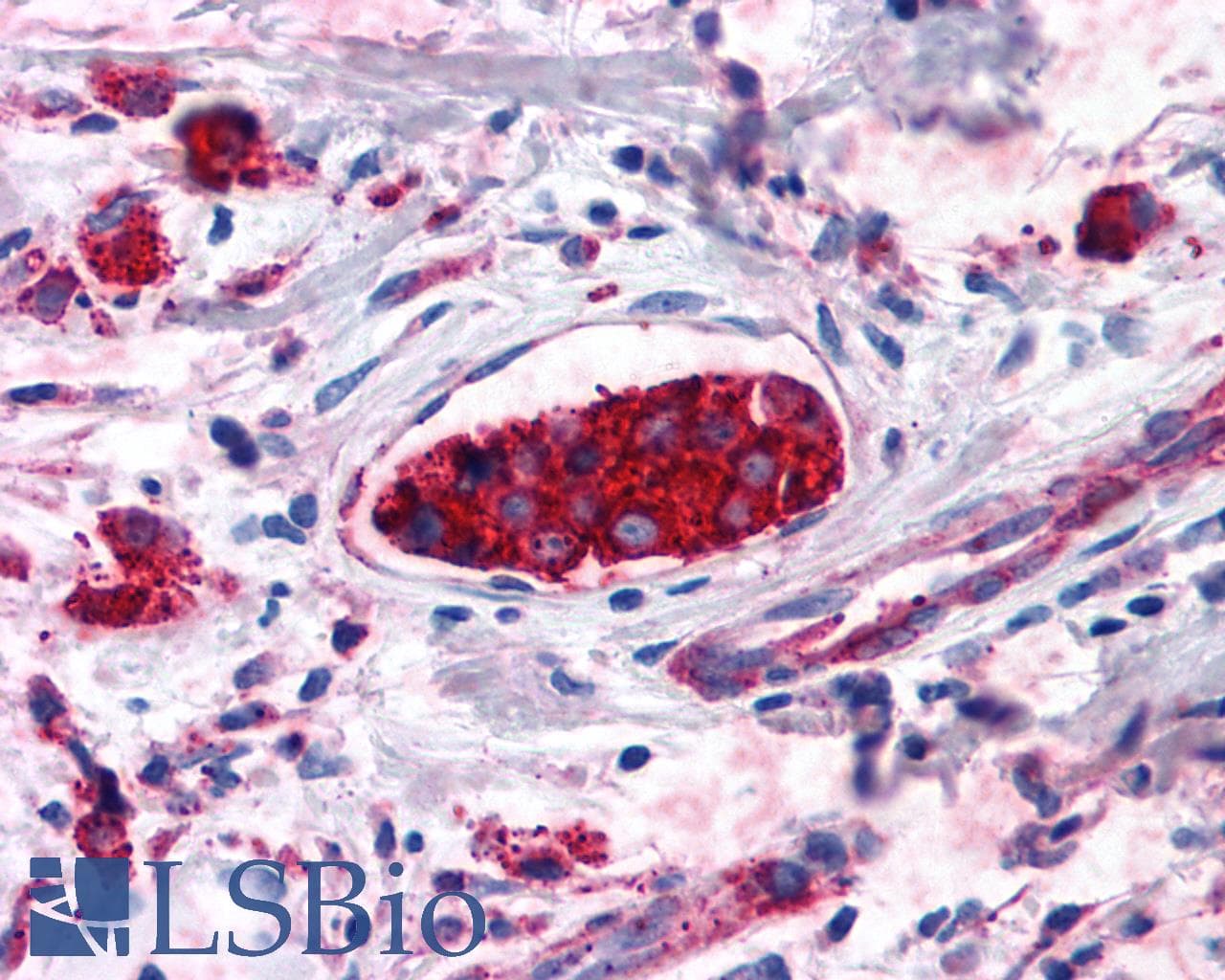 IHC-plus™ CNR2 / CB2 Antibody (Cytoplasmic Domain)